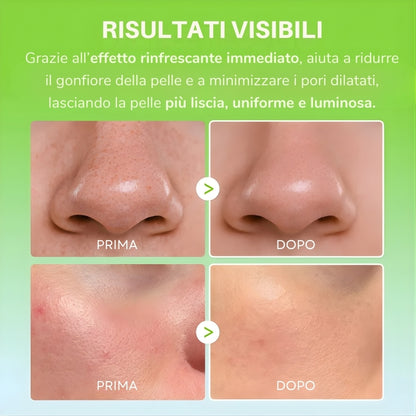 Seravita™ – Balsamo Multi-Azione per Pori Dilatati